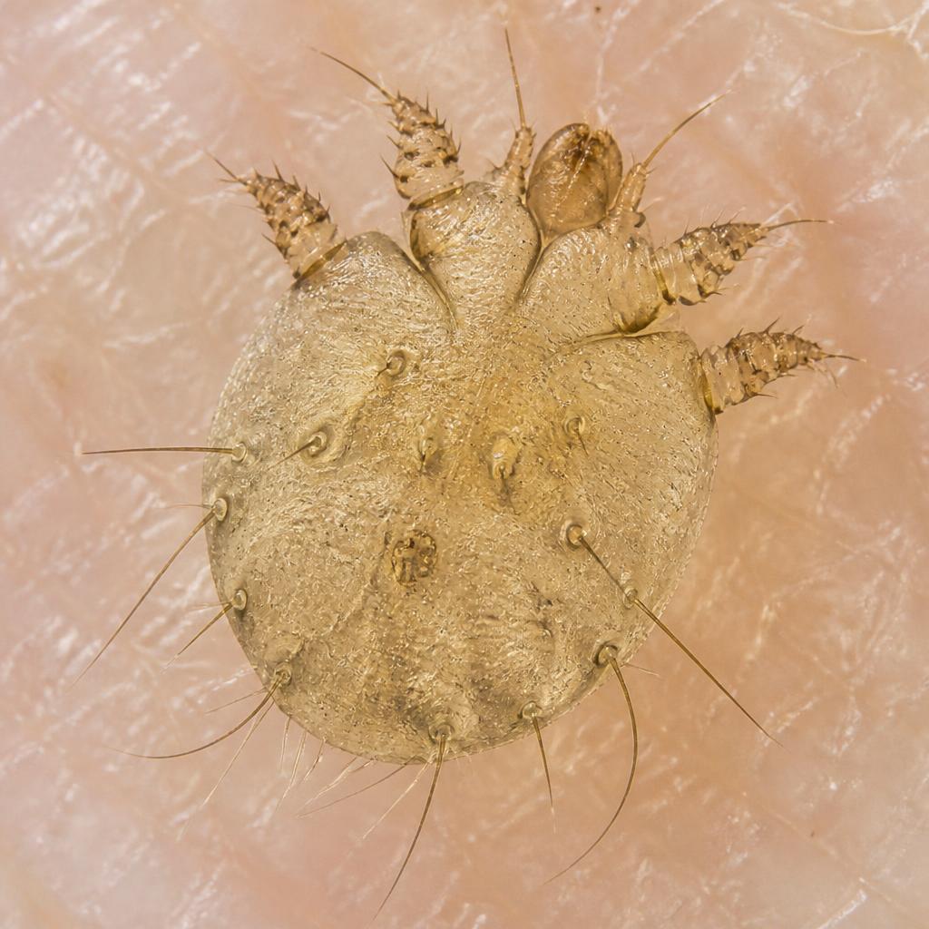 Scabies Mite (Sarcoptes scabiei)